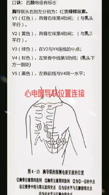 心電圖導聯位置心電圖基礎操作